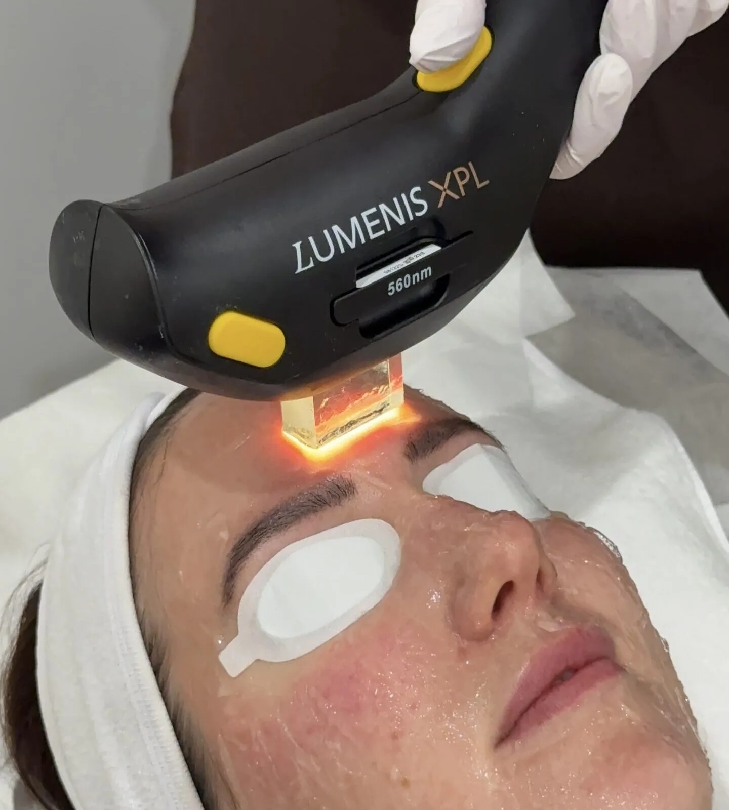Client receiving a skin treatment at Plump Aesthetic Clinic