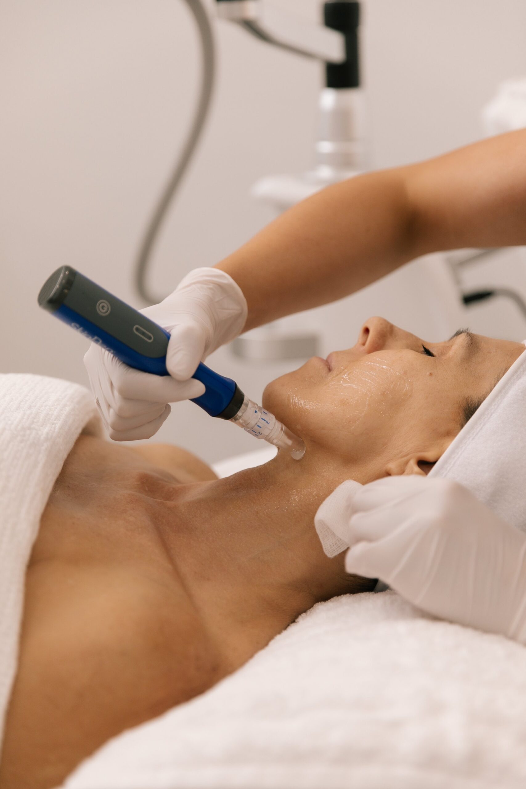 Skin needling treatment being performed on a client's cheek
